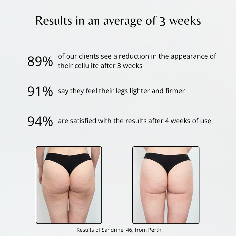 Lumya™ | Leggings 3D